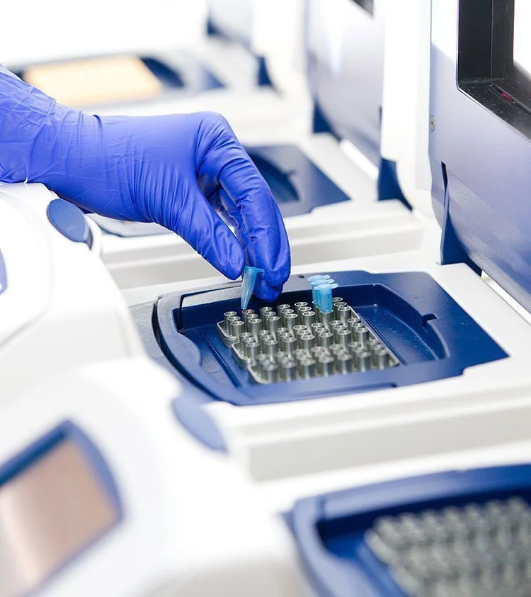 HPLC Analysis